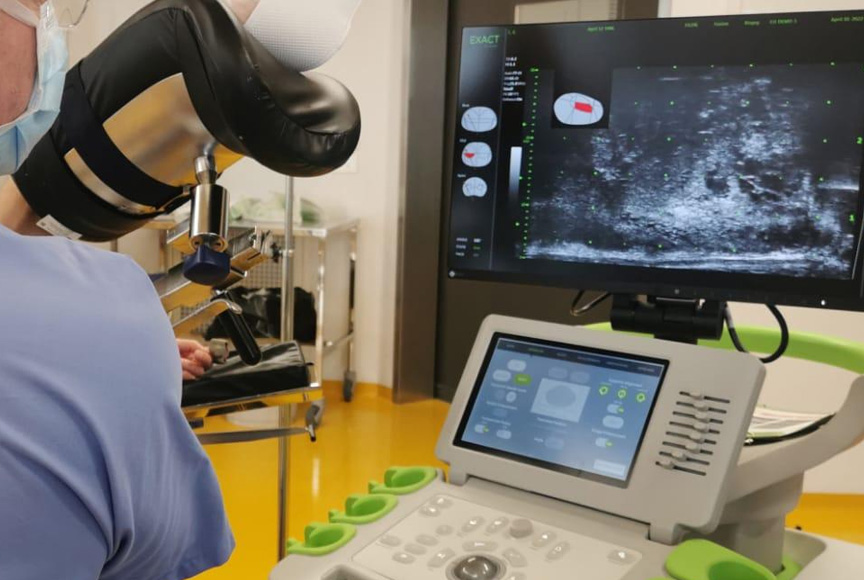 Biopsie prostatique